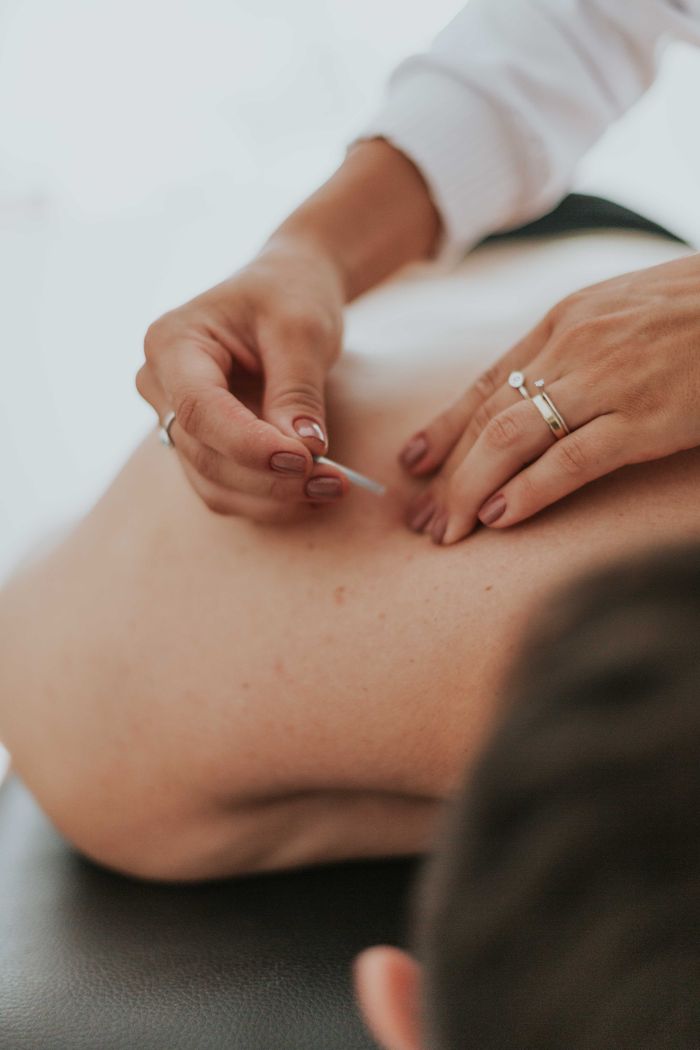 contact-img Close-up of a therapist performing acupuncture on a person's back in a calming environment.